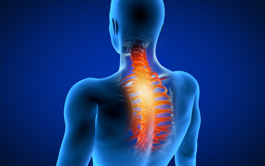 3 common causes of neck pain