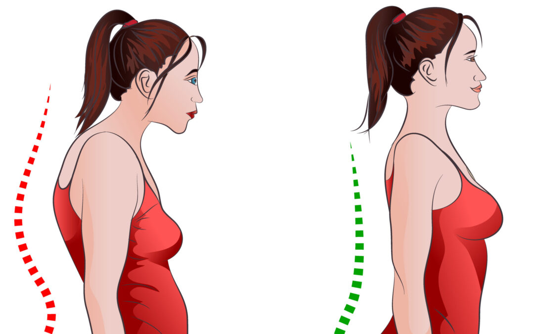 How to Prevent or Reverse Forward Head Posture