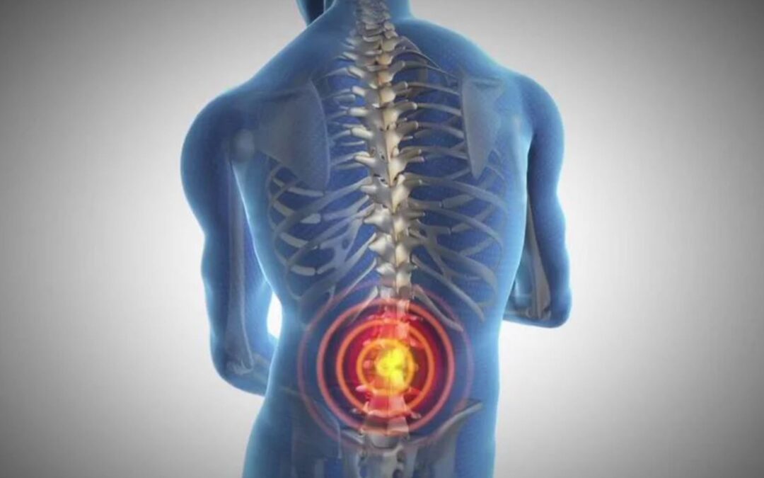 What are the 6 Most Common Causes of Chronic Back Pain?